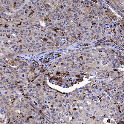 PTPN6 Rabbit Polyclonal Antibody