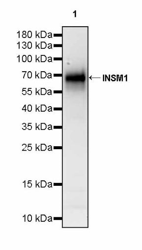 INSM1 Recombinant Rabbit mAb (SDT-3165-72)