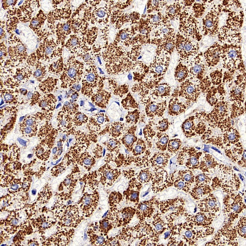 DLST Recombinant Rabbit mAb (S-2283-10)