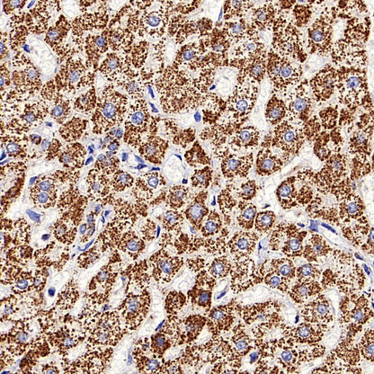 DLST Recombinant Rabbit mAb (S-2283-10)