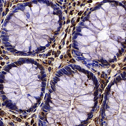 Beta III Tubulin Recombinant Rabbit mAb (S-5529)