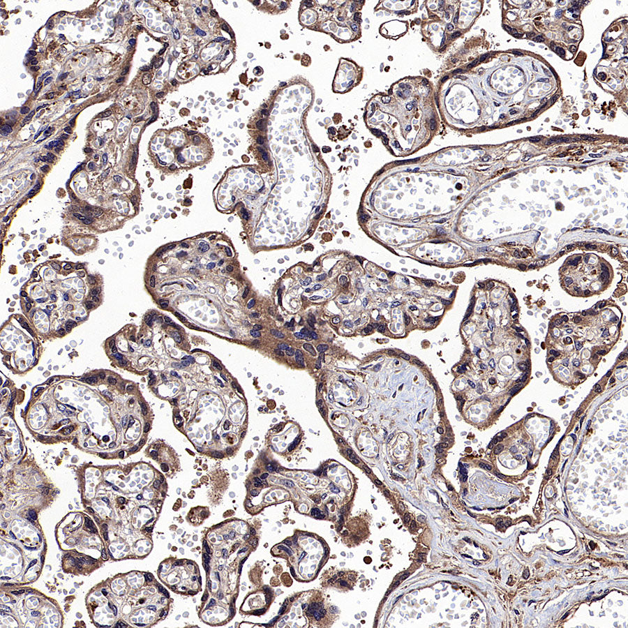 APOL2 Recombinant Rabbit mAb (S-3627-115)