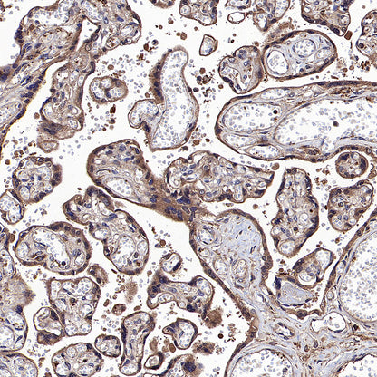 APOL2 Recombinant Rabbit mAb (S-3627-115)
