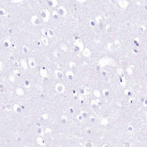 HLA-DPB1 Recombinant Rabbit mAb (S-R263)