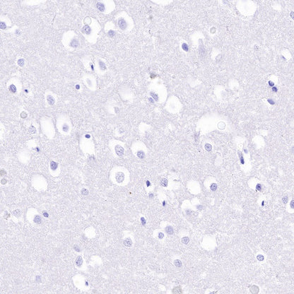 HLA-DPB1 Recombinant Rabbit mAb (S-R263)