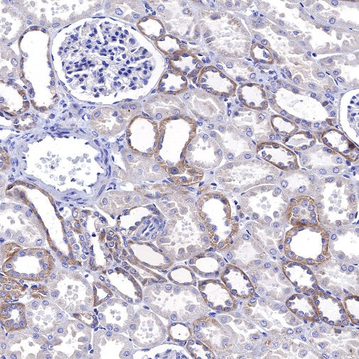 KRAS Recombinant Rabbit mAb (S-443-69)