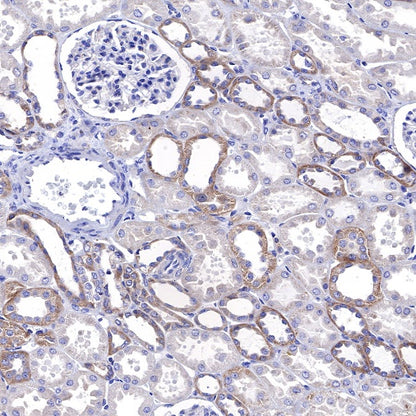 KRAS Recombinant Rabbit mAb (S-443-69)