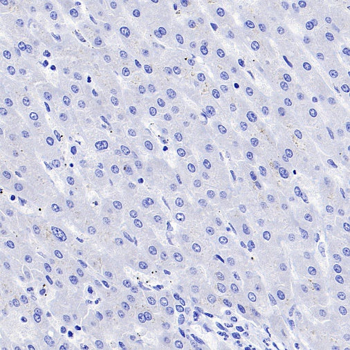 NRGN Recombinant Rabbit mAb (S-1624-60)