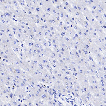 NRGN Recombinant Rabbit mAb (S-1624-60)