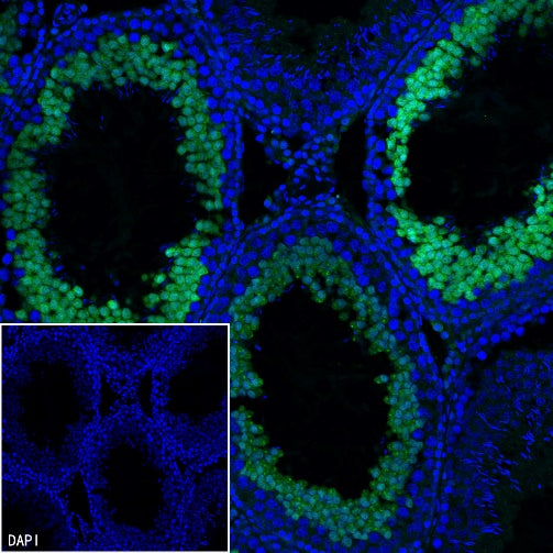 NUT Recombinant Rabbit mAb, PBS Only (SDT-3062)