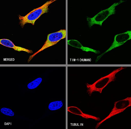 TIM-1 Recombinant Rabbit mAb (S-1555-147)