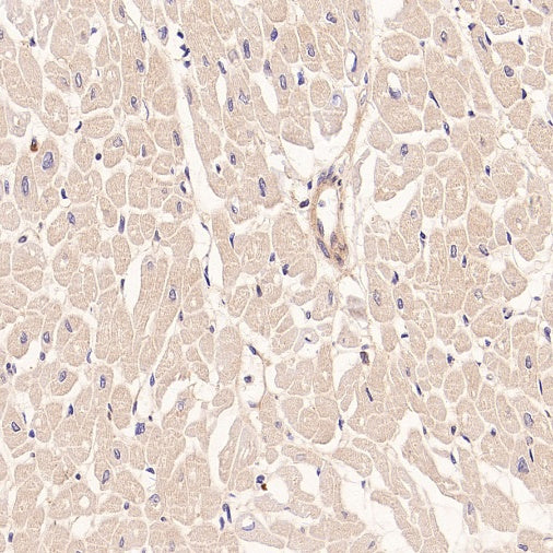 IFT88 Recombinant Rabbit mAb (S-2187-107)