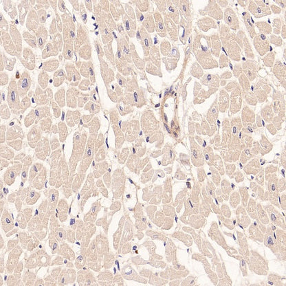 IFT88 Recombinant Rabbit mAb (S-2187-107)