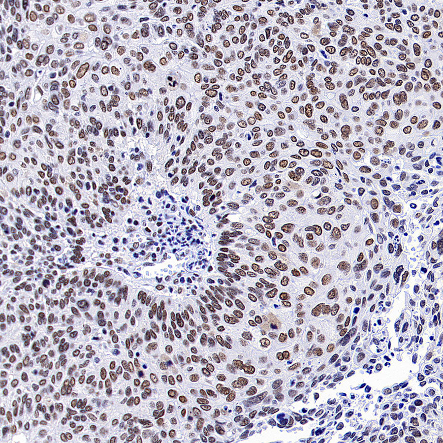 Bmi1 Recombinant Rabbit mAb (S-5143)