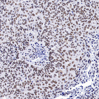 Bmi1 Recombinant Rabbit mAb (S-5143)