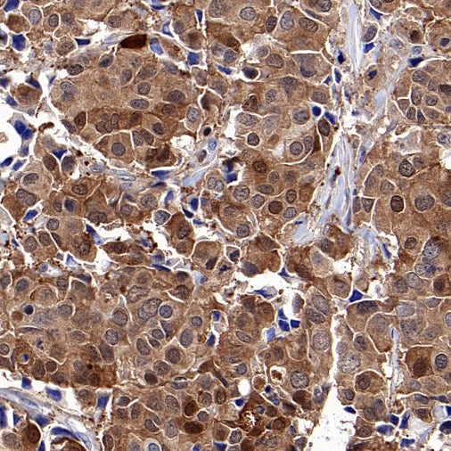 FABP7 Recombinant Rabbit mAb (S-762-41)