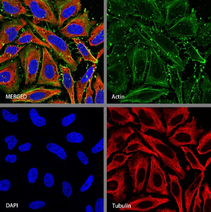 Pan Actin Recombinant Rabbit mAb (S-1365-34)