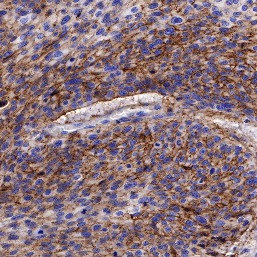 CD138 Recombinant Rabbit mAb,PBS Only (SDT-R120)