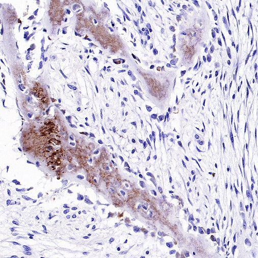 Osteocalcin Recombinant Rabbit mAb ,PBS Only (SDT-2311-37)