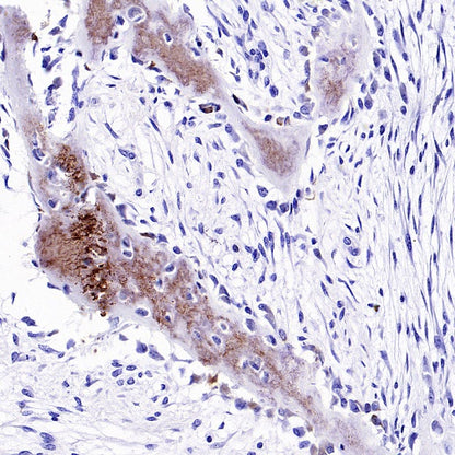 Osteocalcin Recombinant Rabbit mAb ,PBS Only (SDT-2311-37)