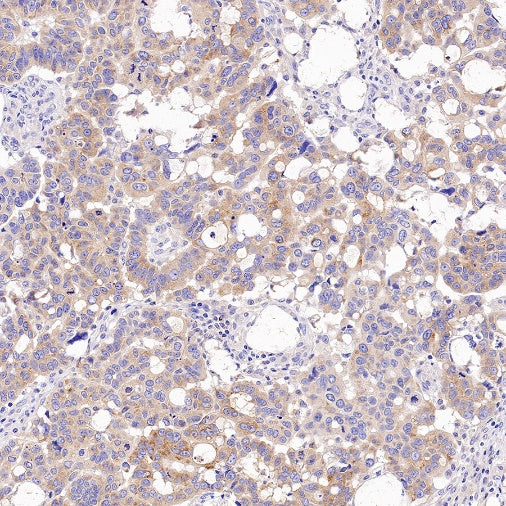 Tuberin/TSC2 Recombinant Rabbit mAb (S-1138-125)