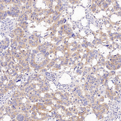 Tuberin/TSC2 Recombinant Rabbit mAb (S-1138-125)