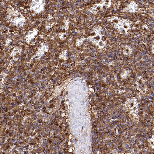 IFITM3 Rabbit Polyclonal Antibody