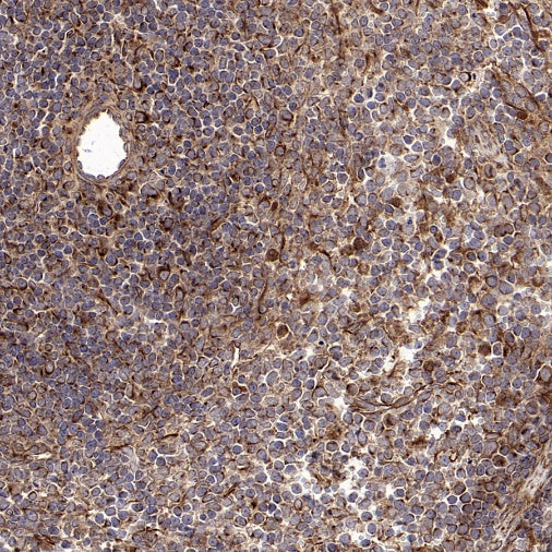 ISL2 Rabbit Polyclonal Antibody
