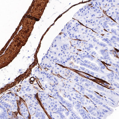 Myosin-11/SMMHC Recombinant Rabbit mAb,PBS Only (SDT-188-112)