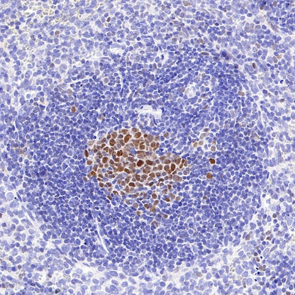 BCL-6 Recombinant Mouse mAb (S-R634)