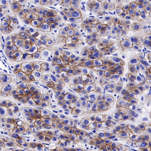 E-Cadherin Recombinant Rabbit mAb (SDT-438-45)
