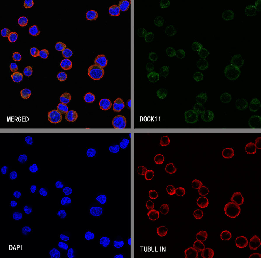 DOCK11 Recombinant Rabbit mAb (S-4420-57)