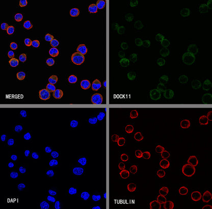 DOCK11 Recombinant Rabbit mAb (S-4420-57)