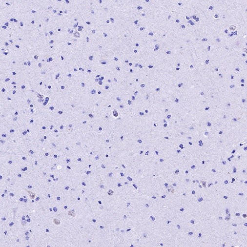 S-RMab® ATRX Recombinant Rabbit mAb (SDT-458-37)