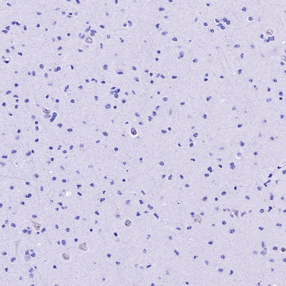 S-RMab® ATRX Recombinant Rabbit mAb (SDT-458-37)