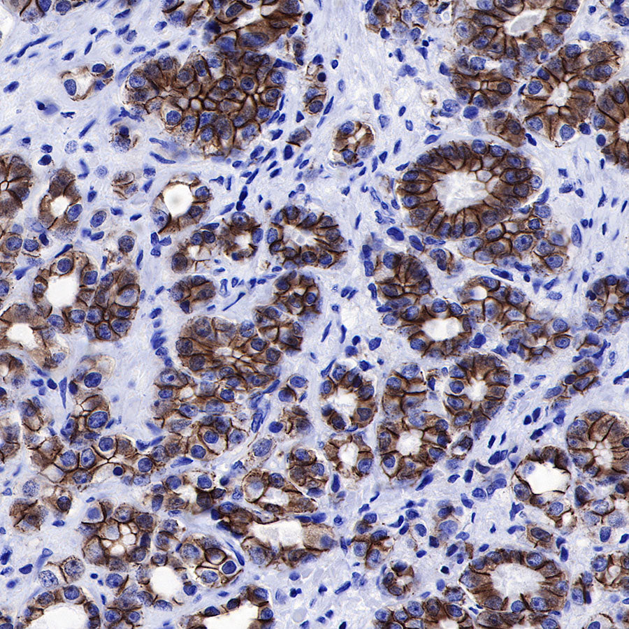 β-Catenin Recombinant Rabbit mAb,PBS Only (SDT-336-23)