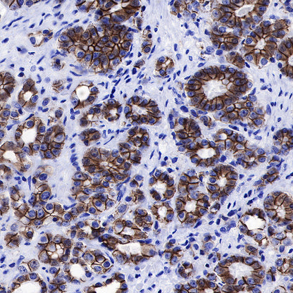 β-Catenin Recombinant Rabbit mAb,PBS Only (SDT-336-23)