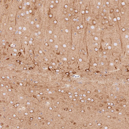 SERCA2 ATPase Recombinant Rabbit mAb (S-5956)