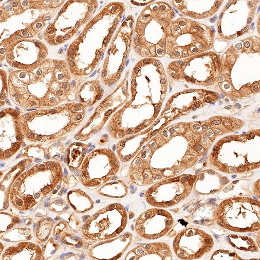 Superoxide Dismutase 1 Recombinant Rabbit mAb (S-1537-39)