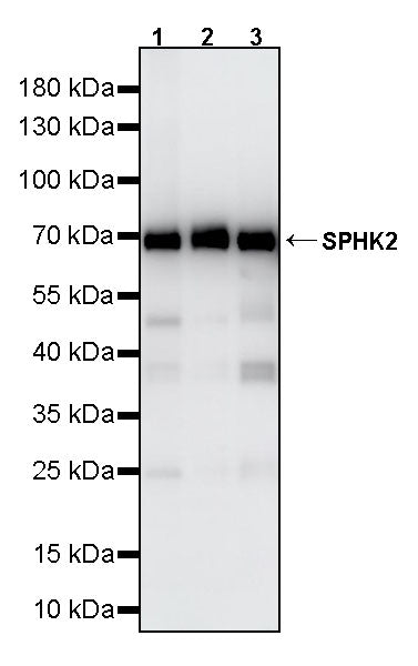 SPHK2 Recombinant Rabbit mAb (S-5307)