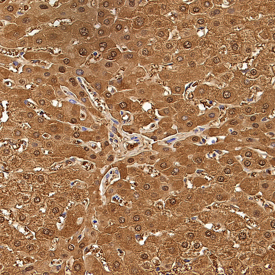 HPD Recombinant Rabbit mAb (S-4536-65)