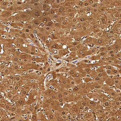 HPD Recombinant Rabbit mAb (S-4536-65)