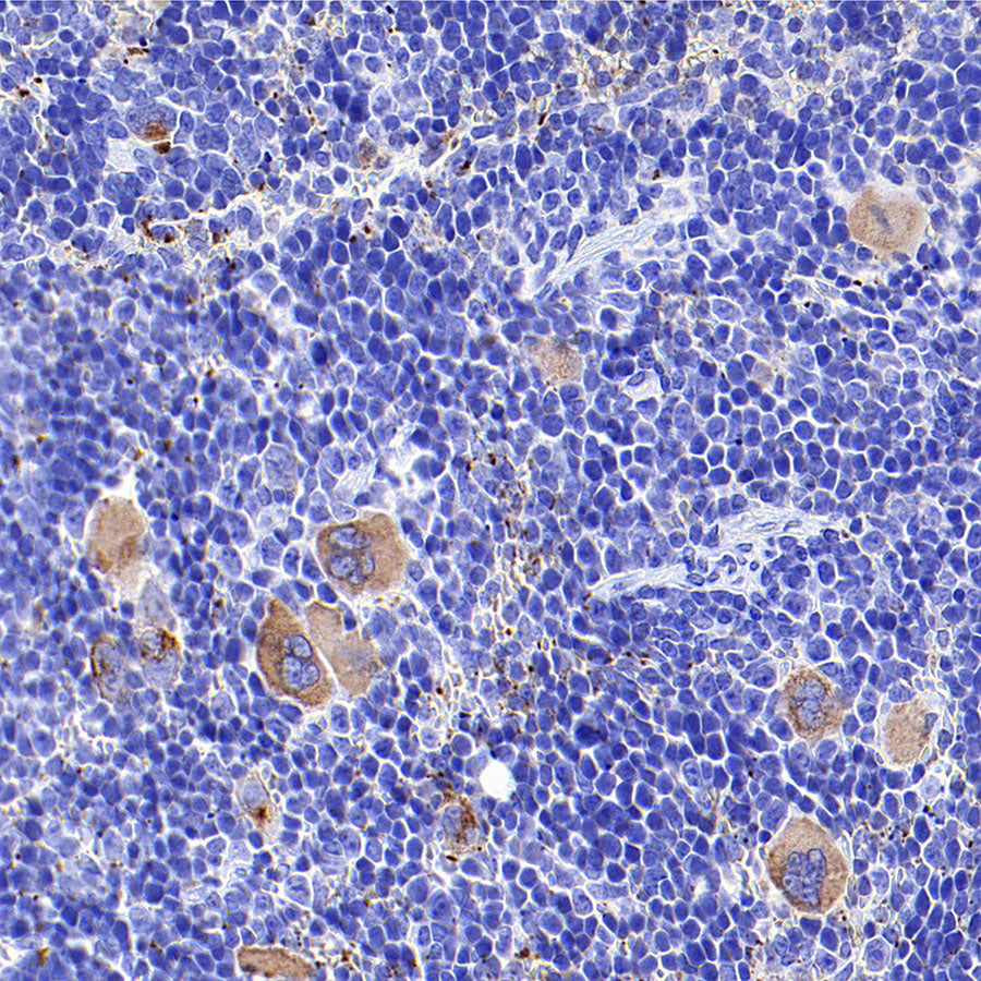 Thrombospondin 1 Recombinant Rabbit mAb (S-4153-22)