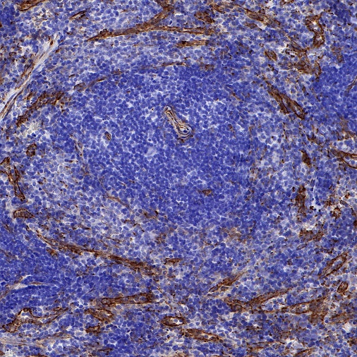 cGAS Recombinant Rabbit mAb (S-708-15)