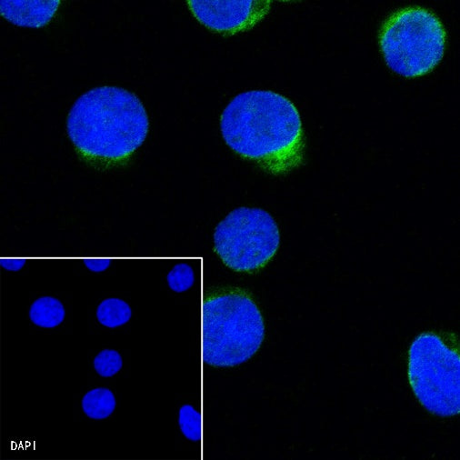 CD25/IL-2Rα Recombinant Rabbit mAb (S-R223)