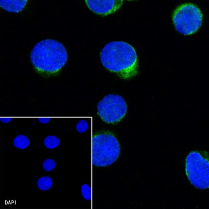 CD25/IL-2Rα Recombinant Rabbit mAb (S-R223)