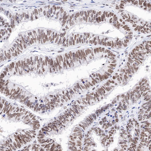 RBM15B Recombinant Rabbit mAb (S-1326-111)