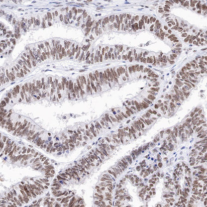 RBM15B Recombinant Rabbit mAb (S-1326-111)