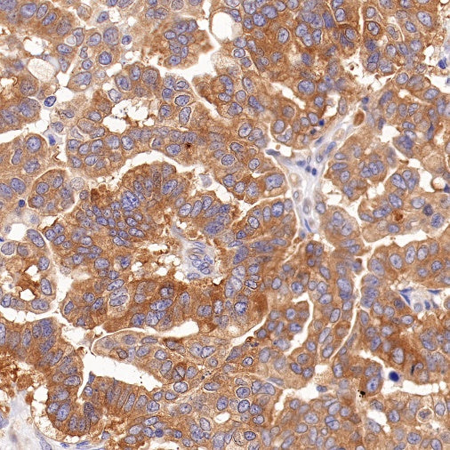 BRAF Recombinant Rabbit mAb (S-1328-60)