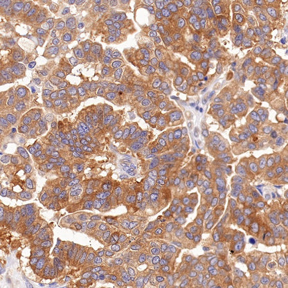 BRAF Recombinant Rabbit mAb (S-1328-60)